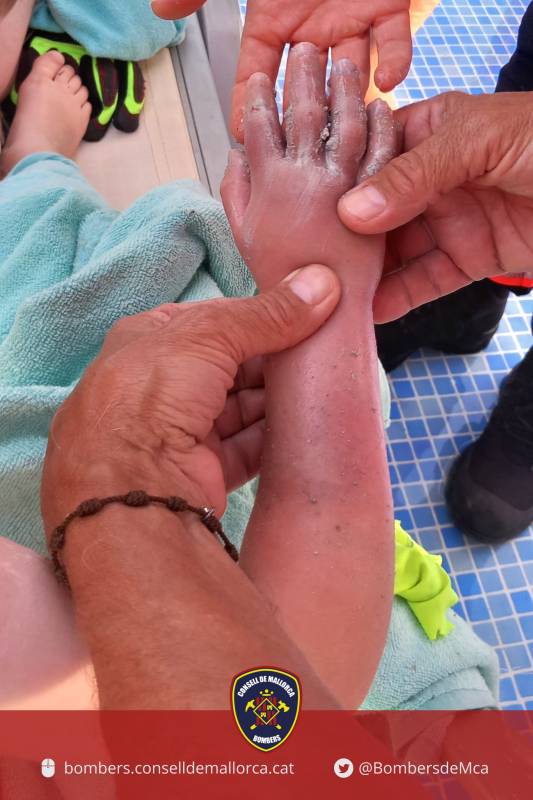 Scare at Mallorca hotel as 4-year-old British boy gets his hand stuck in swimming pool pipe